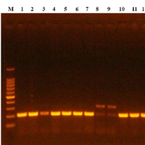 Gel Electrophoresis Of Ph1A Virulence Gene 207 Bp In Serratia