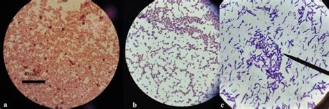 Gram Staining Of A Escherichia Coli B Staphylococcus Aureus And Download Scientific