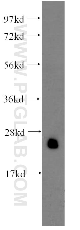 TPI1 Antibody 60036 2 Ig Proteintech