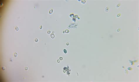 how to gauge yeast viability in a microscope | Homebrew Talk - Beer ...