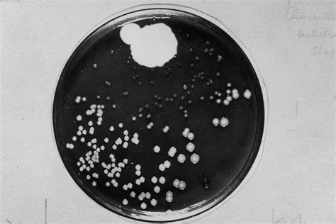 A Hist Ria Da Penicilina O Antibi Tico Criado No Mundo