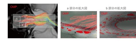 ニュース :: 【研究発表】超高磁場MRIと神経トラクトグラフィーによる嗅神経の可視化に世界で初めて成功 ―嗅覚障害を診断するための新しい検査 ...