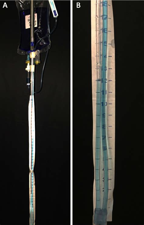 A: The intra-abdominal pressure measurement system is attached to a 500 ...