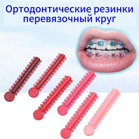 Лигаторные кольца ортодонтические резиновые (3 пакетика) - купить с ...