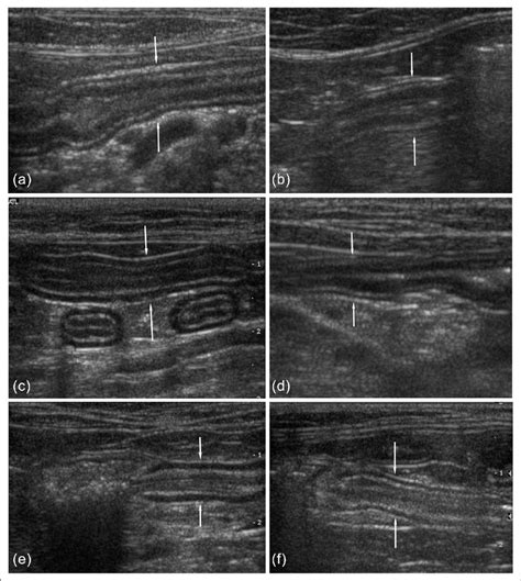 Duodenum Jejunum Ileum Cat