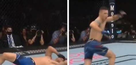 Chris Weidman Suffers Gruesome Leg Injury In UFC Fight Against Uriah