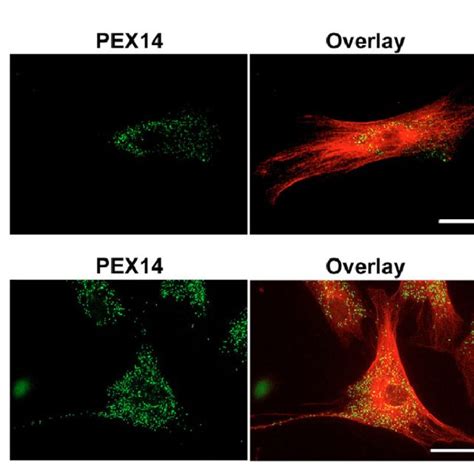 Peroxisome Abundance And Distribution Along Peripheral Microtubules Are