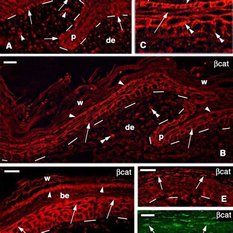 Podarcis Muralis Immunofluorescence For Beta Catenin βcat Using Download Scientific Diagram