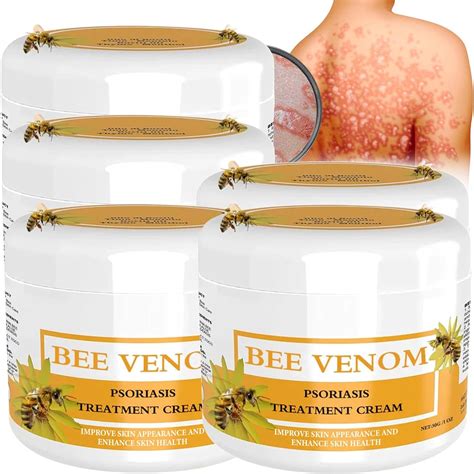 Cvreoz Bee Venom Psoriasis Treatment Cream Psoriasis Moisturizing And