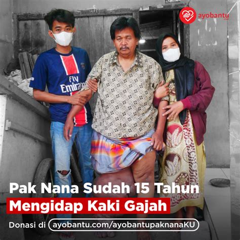 Urgent Pak Nana Harus Segera Operasi Kaki Gajah