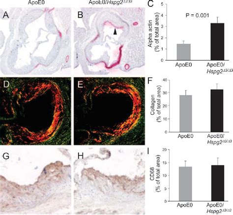 Figure 6 From Heparan Sulfate In Perlecan Promotes Mouse