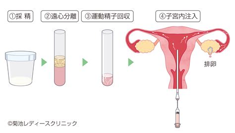 不妊治療用語 菊池レディースクリニック