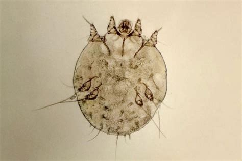 Scabies Kudis Buta Tanda Rawatan Diagnosis Punca