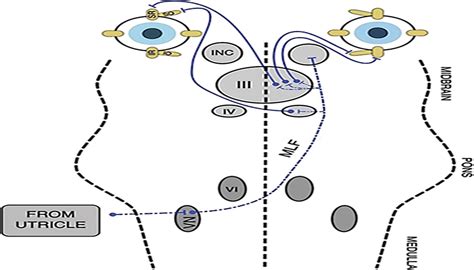 Hints Examination In Acute Vestibular Neuritis Do Not Look Journal Of Neuro Ophthalmology