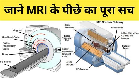 MRI Scan What Is MRI Scan YouTube