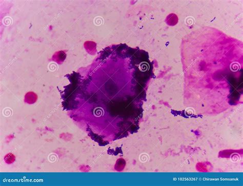 Cellula Dei Batteri Nel Metodo Della Colorazione Di Gram Immagine Stock