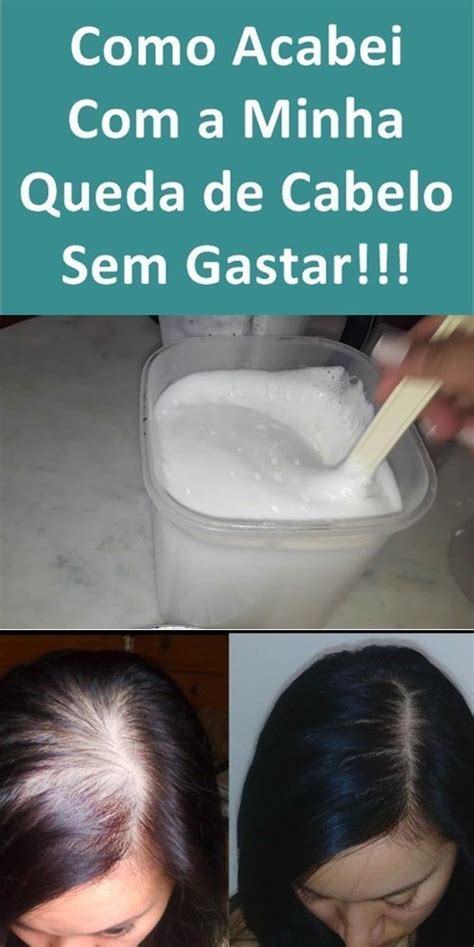 O Que Fazer Para Queda De Cabelo Urgente Confira A Solu O Aqui