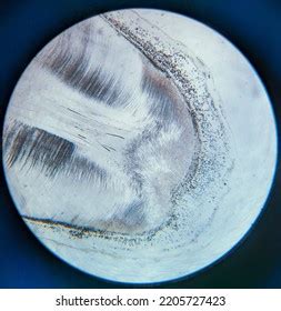 Photo Human Tooth Tissue Under Microscope Stock Photo 2205727423 ...