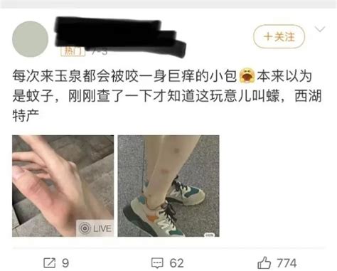 身上突然不明原因痒一下、又红又肿 是什么咬的？ 科技与健康 Cnbetacom