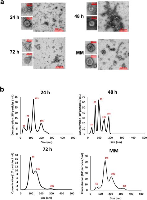 Biophysical characterization of exosomes isolated from MM and ... 