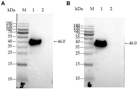 Frontiers Development Of A Colloidal Gold Immunochromatographic Assay Strip Using Monoclonal