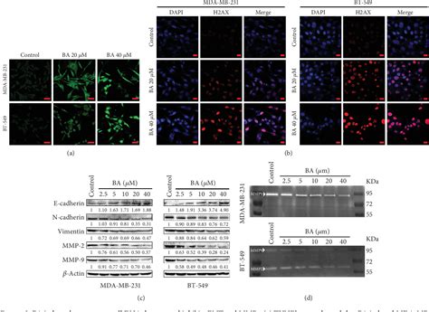 Figure From Betulinic Acid Suppresses Breast Cancer Metastasis By