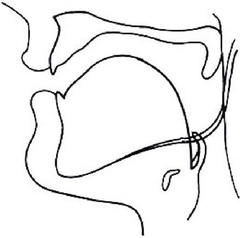 Section of the glottal plosive [ ]. | Download Scientific Diagram