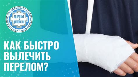 3 этапа восстановления руки после перелома