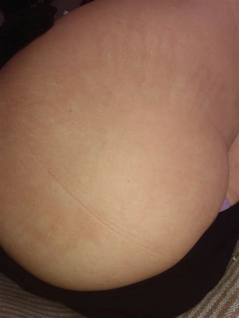 Slutty Wife Showing Result Of Slaps And Pussy Cumshot Pics XHamster