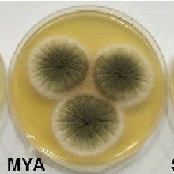 Cultural Characteristics Of Aspergillus Niger Grown On Potato Dextrose