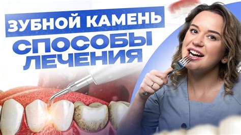 3 способа удаления зубного камня в домашних условиях и их последствия ...