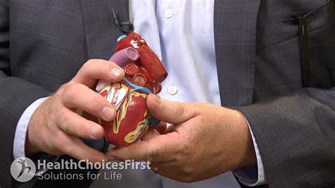 Cabg Coronary Artery Bypass Graft Surgery Health Choices First