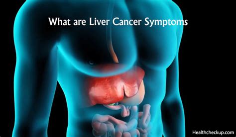 Liver Cancer Symptoms & Causes in Males and Females | Treatment for ...