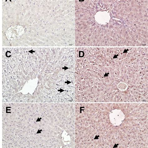 Immunohistochemical Stainings Of Different Groups Ki 67 Left Column Download Scientific