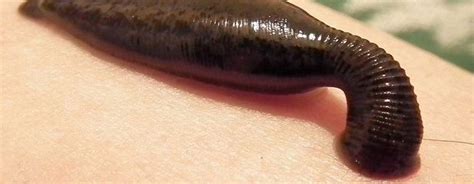 Гирудокосметология: использование пиявок | Blutegel, Angeln, Wels angeln