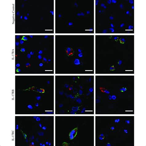 Il 17ra Il 17rb And Il 17rc Showed Differential Pattern Of