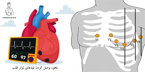 نوار قلب آموزش نحوه گرفتن نوارقلب با دستگاه Ecg