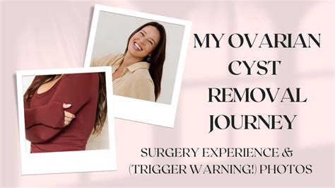 My Ovarian Cyst Removal Journey Surgery And Trigger Warning Photos