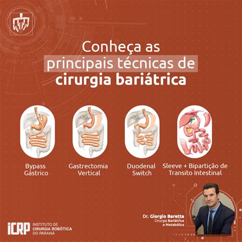 Conhe A As Principais T Cnicas De Cirurgia Bari Trica Instituto De