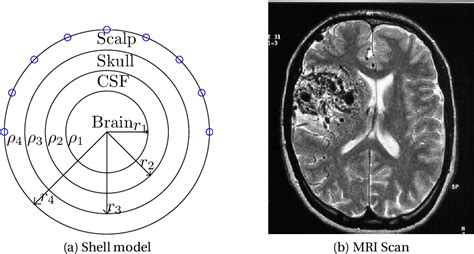 Figure 21 From Bayesian Meeg Source Localization With Possible Joint