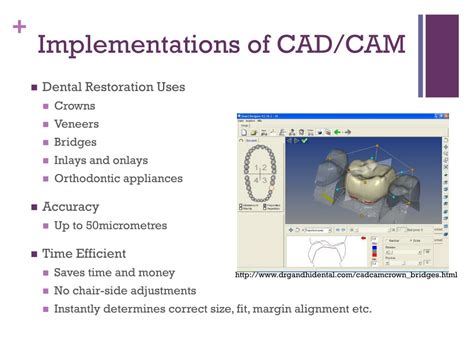 PPT - CAD/CAM Dentistry PowerPoint Presentation, free download - ID:2255970