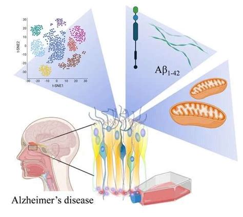 Human Olfactory Mucosa Cell Model Opens A New Perspective On Alzheimer