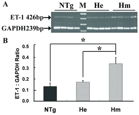 A Ethidium Bromide Stained Agarose Gels Of Rt Pcr Products Of Et