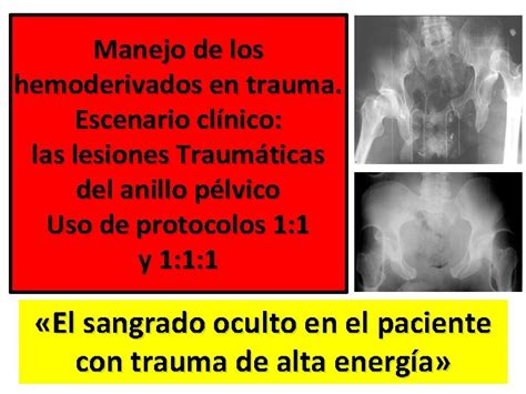 Manejo Racional De Los Hemoderivados Escenario Clnico Fracturas