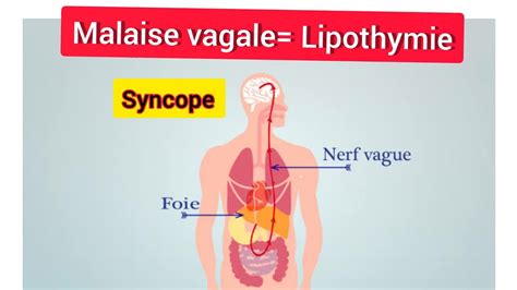 Malaise Vagale Lipothymie Youtube