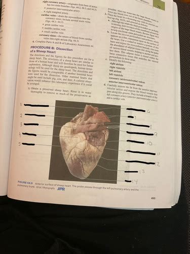 Heart Dissection Flashcards Quizlet