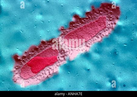 E Coli Bakterien Escherichia Coli Ist Ein Gram Negative Fakultativ