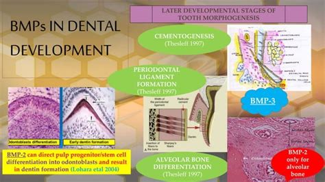 Bone Morphogenetic Proteins Role In Periodontal Regeneration Ppt