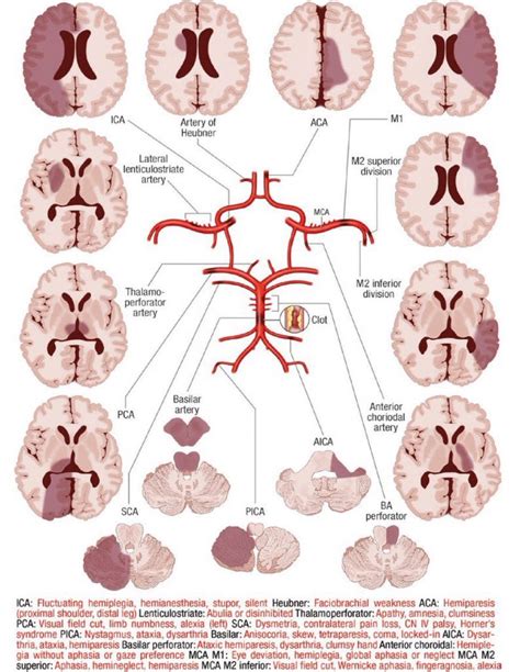 Oren Gottfried Md On Twitter Great Post From A Charidimou On