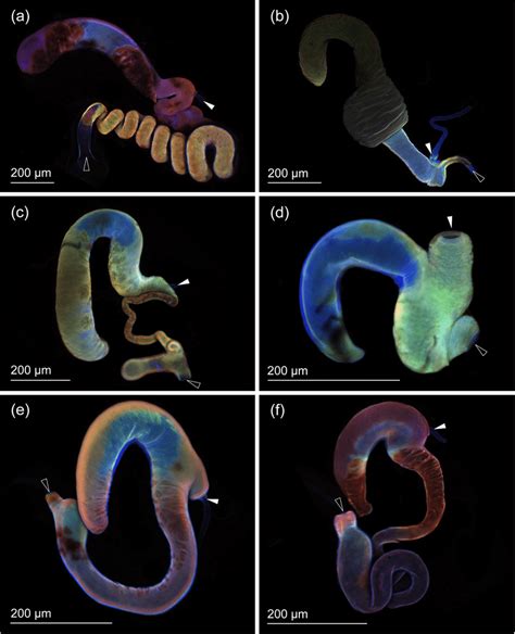 Confocal Laser Scanning Micrographs Of Spermathecae The White